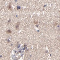 HPA IHC Cerebral cortex — MAP2K2