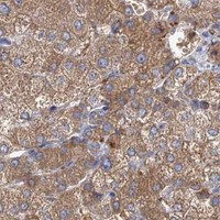 HPA IHC Liver — UBASH3B