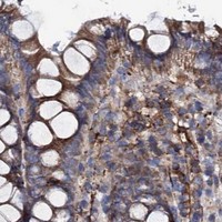 HPA IHC Colon — UBASH3B