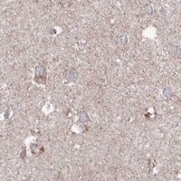 HPA IHC Cerebral cortex — GLS2