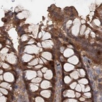 HPA IHC Colon — TOLLIP