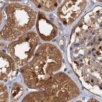 HPA IHC Kidney — TOLLIP