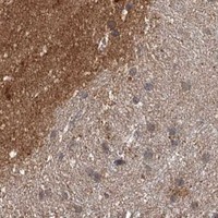 HPA IHC Cerebral cortex — TOLLIP