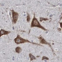 HPA IHC Cerebral cortex — MIA2
