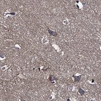 HPA IHC Cerebral cortex — EYA4