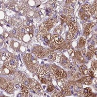 HPA IHC Liver — ZC3H12C