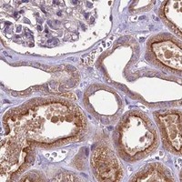 HPA IHC Kidney — ZC3H12C