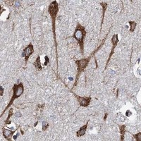 HPA IHC Cerebral cortex — HSPA5