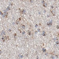 HPA IHC Cerebral cortex — NDUFB8