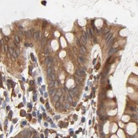 HPA IHC Colon — BCAP31