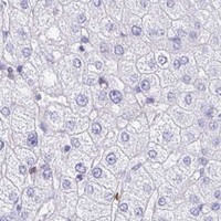 HPA IHC Liver — CD7