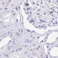 HPA IHC Kidney — CD7