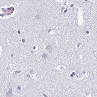 HPA IHC Cerebral cortex — CD7