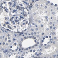 HPA IHC Kidney — SOX6