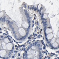 HPA IHC Colon — SOX6