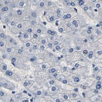 HPA IHC Liver — SOX6