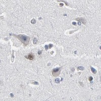 HPA IHC Cerebral cortex — SOX6