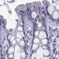 HPA IHC Colon — ACRBP