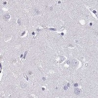 HPA IHC Cerebral cortex — ACRBP