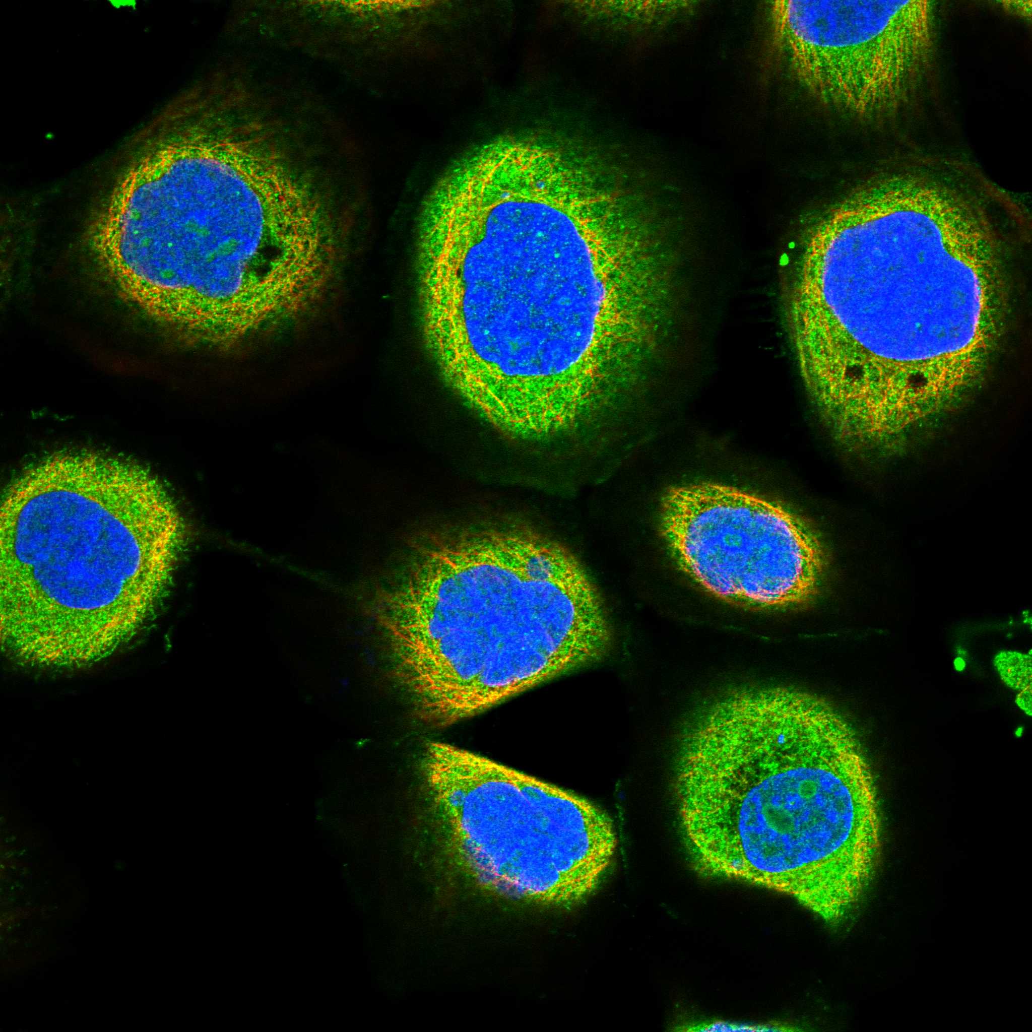 Subcellular AKAP11 The Human Protein Atlas