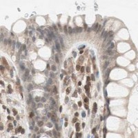 HPA IHC Colon — UBE2I