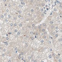 HPA IHC Liver — UBE2I