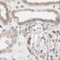 HPA IHC Kidney — UBE2I