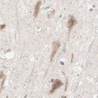 HPA IHC Cerebral cortex — UBE2I