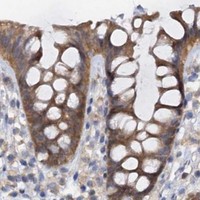 HPA IHC Colon — IDI1