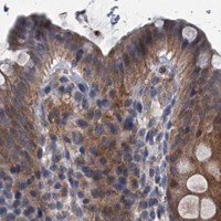HPA IHC Colon — OTUB1