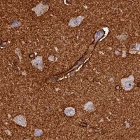 HPA IHC Cerebral cortex — LATS2