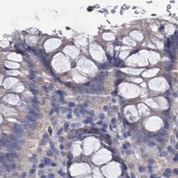 HPA IHC Colon — NPAS4