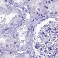 HPA IHC Kidney — SKA3