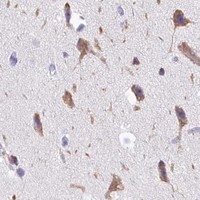 HPA IHC Cerebral cortex — SKA3