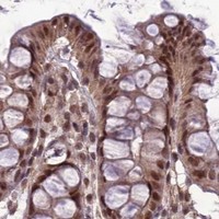 HPA IHC Colon — DIS3
