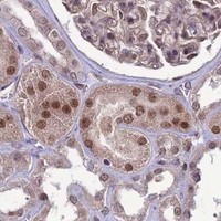 HPA IHC Kidney — DIS3