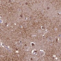 HPA IHC Cerebral cortex — DIS3
