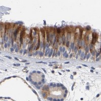 HPA IHC Nasopharynx — CCDC134