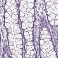 HPA IHC Colon — MIOX
