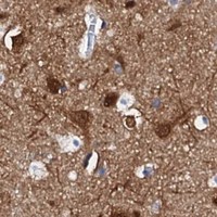 HPA IHC Cerebral cortex — FBXL16