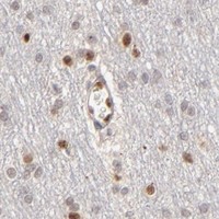 HPA IHC Cerebral cortex — NFIB