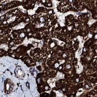 HPA IHC Liver — HADH