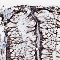 HPA IHC Colon — HADH