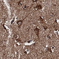 HPA IHC Cerebral cortex — HADH