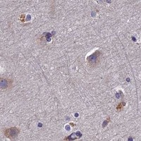 HPA IHC Cerebral cortex — NCAPG