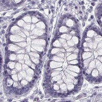 HPA IHC Colon — CASR