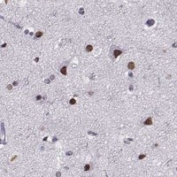 HPA IHC Cerebral cortex — PRMT8