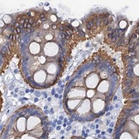 HPA IHC Colon — RAB3IP