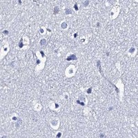 HPA IHC Cerebral cortex — RAB3IP