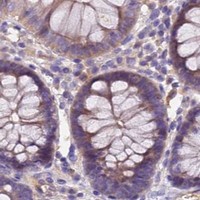 HPA IHC Colon — NEDD4